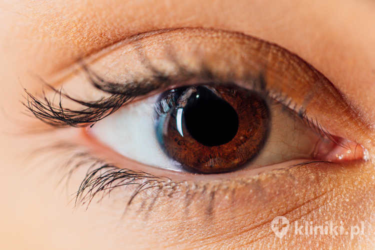 Zabieg laserowego udrażniania dróg łzowych wykonywany jest zazwyczaj w znieczuleniu miejscowym i trwa krótko