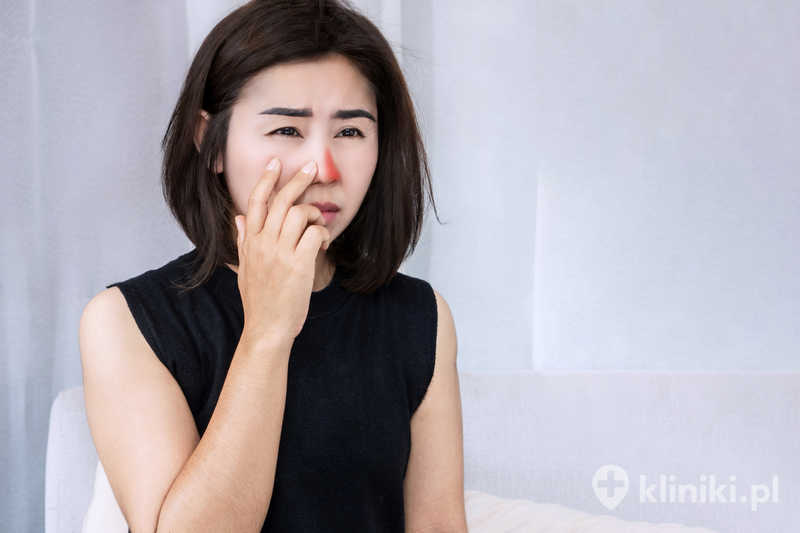 Leczenie chirurgiczne zatok szczękowych pomaga zmniejszyć dolegliwości, takie jak ból, uczucie rozpierania i nawracające infekcje