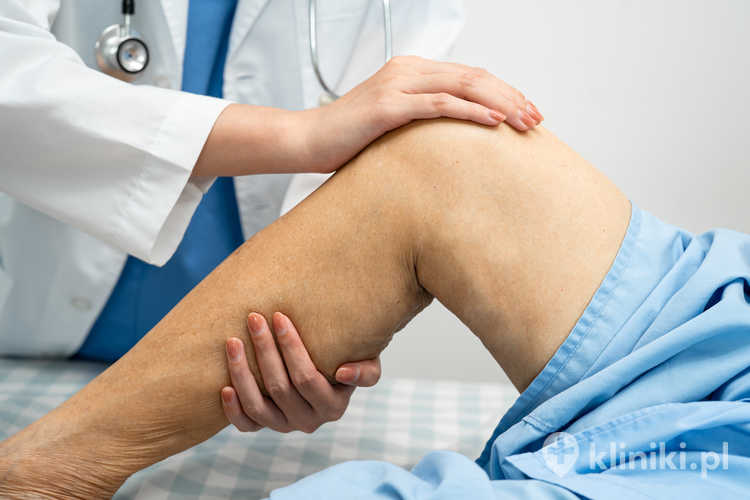 Artroskopia lecznicza stawu kolanowego bywa zalecana przy nieskuteczności leczenia zachowawczego
