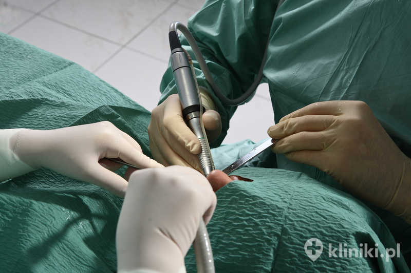 Chirurgiczne leczenie progenii przeprowadzane jest w znieczuleniu ogólnym i wymaga okresu rekonwalescencji oraz dalszej kontroli specjalistycznej