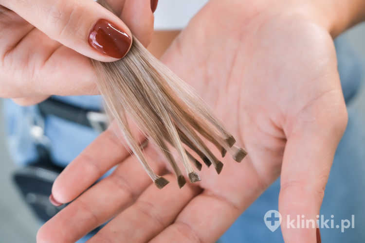 Zabiegi zagęszczania włosów dobierane są indywidualnie, w zależności od przyczyny przerzedzenia oraz oczekiwań pacjenta