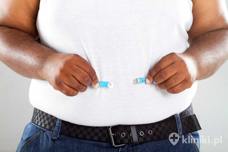 Zabieg endoskopowego zmniejszenia żołądka metodą Overstitch sprzyja redukcji masy ciała oraz poprawie chorób współistniejących z otyłością