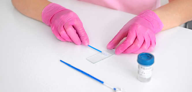 HPV co-test - metoda wykrywania ryzyka rozwoju raka szyjki macicy