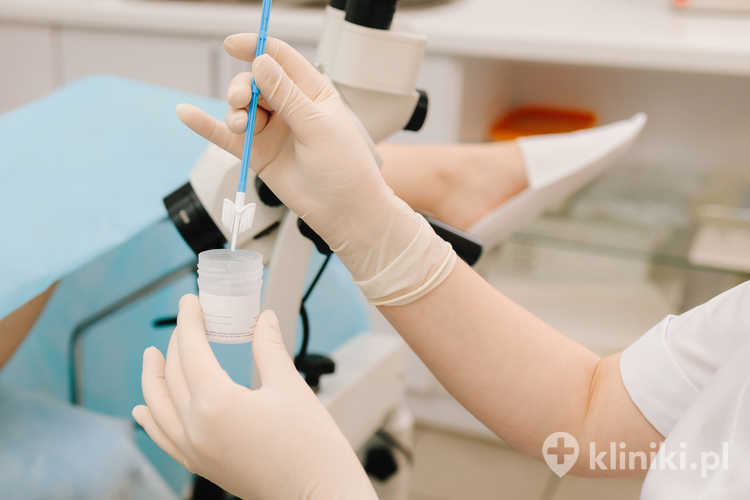 HPV co-test zwiększa skuteczność profilaktyki i zmniejsza ryzyko wyników fałszywie ujemnych