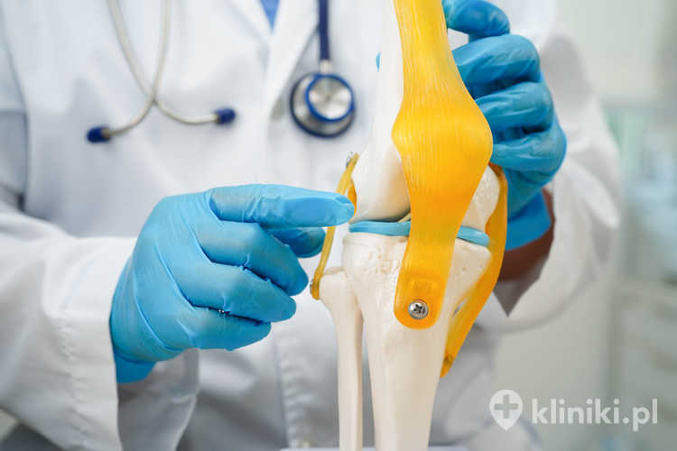 Operacja chrząstki stawu kolanowego może poprawić stabilność i zakres ruchu