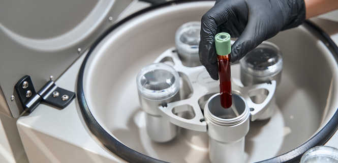 Schorzenia leczone przy pomocy komórek macierzystych Angel System