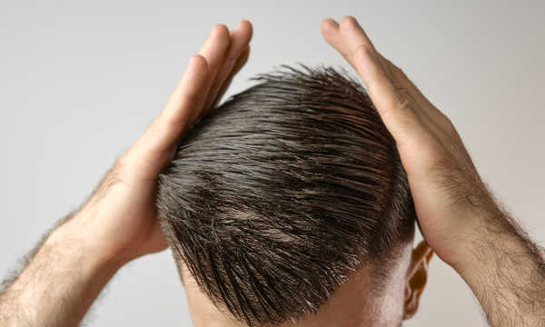 Terapia komórkami macierzystymi a łysienie może wspierać przejście włosów do fazy wzrostu.