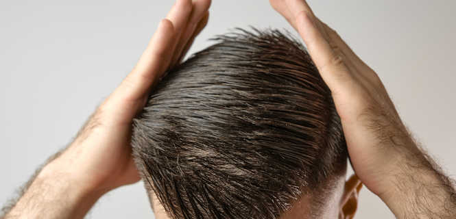 Łysienie a komórki macierzyste