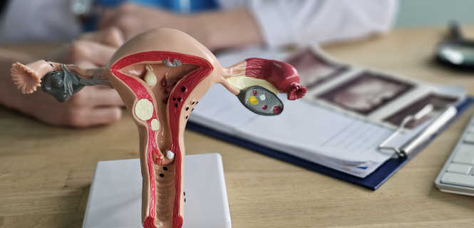 Jakie są wskazania do zabiegu usunięcia macicy?