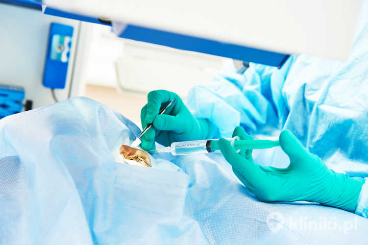 Zabieg cross-linking w leczeniu stożka rogówki wzmacnia strukturę rogówki i hamuje postęp choroby