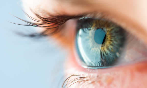 Zabieg korekcji położenia punktów łzowych metodą LAZY-T polega na przywróceniu prawidłowego ustawienia punktów łzowych względem gałki ocznej