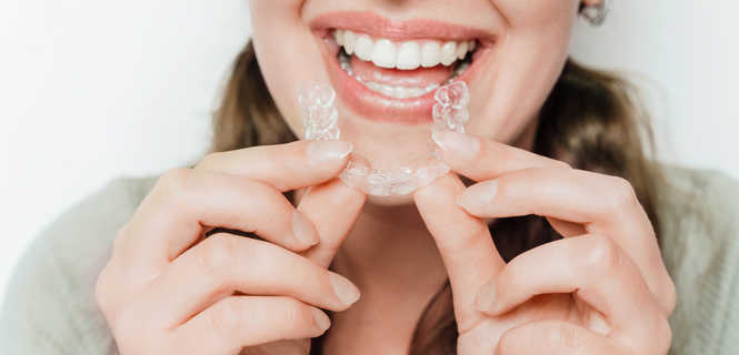 Rodzaje aparatów ortodontycznych - porównanie