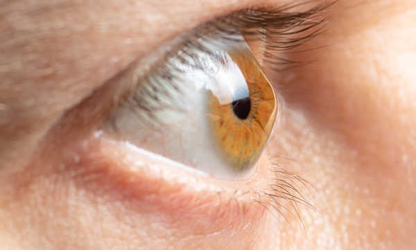 Topografia rogówki pozwala wykryć nieregularności i wady refrakcji, np. stożek rogówki