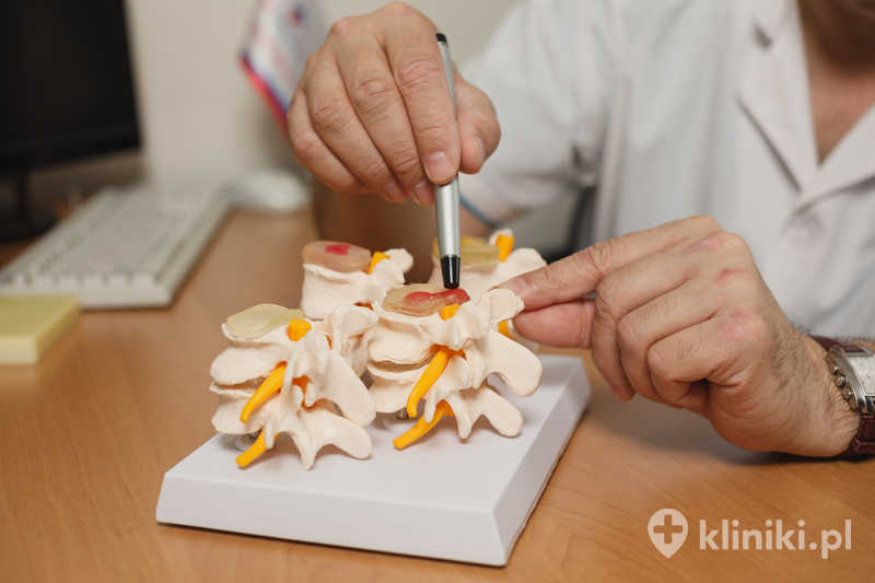 W niektórych przypadkach leczenie dyskopatii szyjnej wymaga zastosowania blokad przeciwbólowych lub innych procedur małoinwazyjnych W niektórych przypadkach leczenie dyskopatii szyjnej wymaga zastosowania blokad przeciwbólowych lub innych procedur małoinwazyjnych