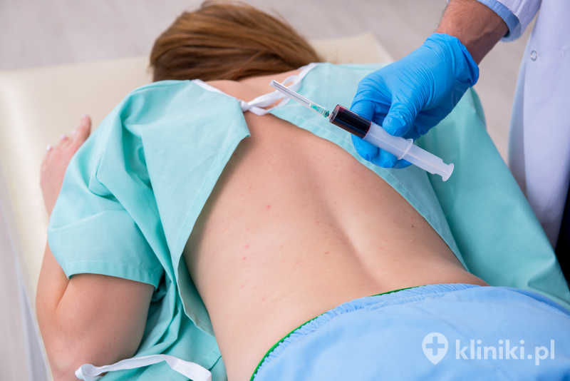 Leczenie bólu kręgosłupa termolezją polega na kontrolowanym uszkodzeniu włókien nerwowych przewodzących bodźce bólowe Leczenie bólu kręgosłupa termolezją polega na kontrolowanym uszkodzeniu włókien nerwowych przewodzących bodźce bólowe