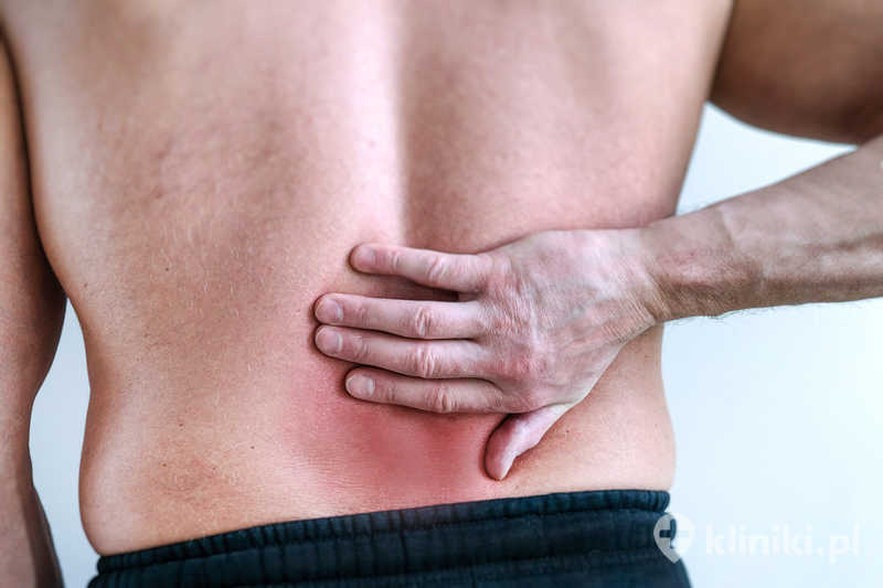 Leczenie bólu kręgosłupa termolezją stosuje się najczęściej w przypadku bólu pochodzącego ze stawów międzykręgowych Leczenie bólu kręgosłupa termolezją stosuje się najczęściej w przypadku bólu pochodzącego ze stawów międzykręgowych