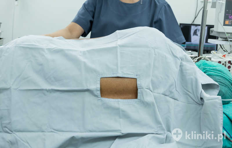 Leczenie bólu kręgosłupa termolezją wykonuje się z użyciem specjalnej elektrody wprowadzanej w okolice nerwu pod kontrolą obrazowania Leczenie bólu kręgosłupa termolezją wykonuje się z użyciem specjalnej elektrody wprowadzanej w okolice nerwu pod kontrolą obrazowania