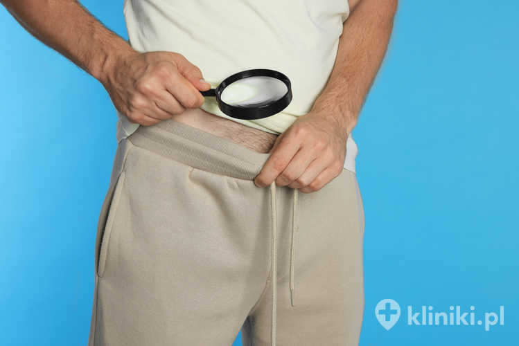 Objawem krótkiego wędzidełka prącia bywa trudność w pełnym odprowadzeniu napletka