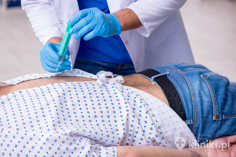 Wertebroplastyka wykonywana jest zwykle pod kontrolą obrazowania radiologicznego