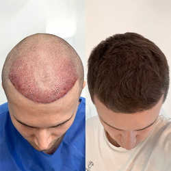 FullFace Clinic, Warszawa - opinie i cennik 2026