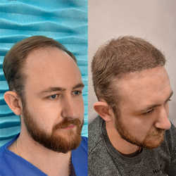 FullFace Clinic, Warszawa - opinie i cennik 2026