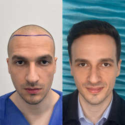 FullFace Clinic, Warszawa - opinie i cennik 2026