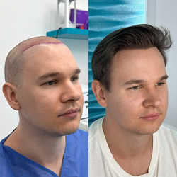 FullFace Clinic, Warszawa - opinie i cennik 2026