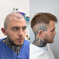 FullFace Clinic, Warszawa - opinie i cennik 2026