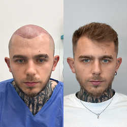 FullFace Clinic, Warszawa - opinie i cennik 2026