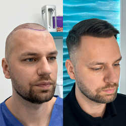 FullFace Clinic, Warszawa - opinie i cennik 2026