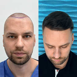 FullFace Clinic, Warszawa - opinie i cennik 2026