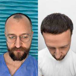 FullFace Clinic, Warszawa - opinie i cennik 2026