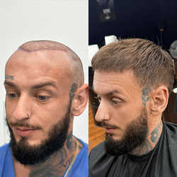 FullFace Clinic, Warszawa - opinie i cennik 2026