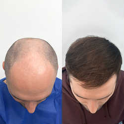 FullFace Clinic, Warszawa - opinie i cennik 2026