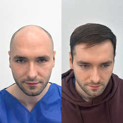 FullFace Clinic, Warszawa - opinie i cennik 2026