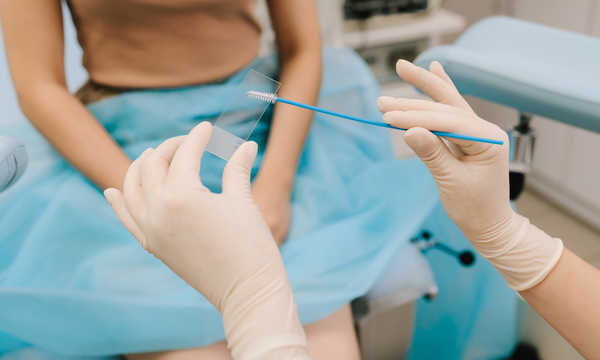 Cytologia płynna zwiększa skuteczność wykrywania zmian przedrakowych i wczesnych stadiów raka szyjki macicy