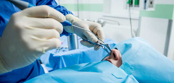 Jak przebiega rekonwalescencja po zabiegu FESS?