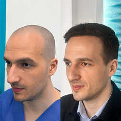 FullFace Clinic, Warszawa - opinie i cennik 2026