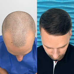 FullFace Clinic, Warszawa - opinie i cennik 2026