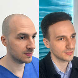 FullFace Clinic, Warszawa - opinie i cennik 2026