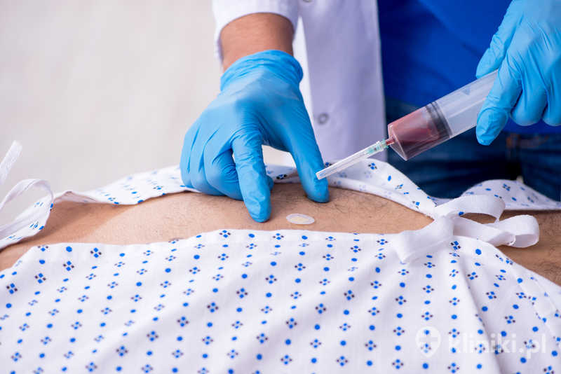 Iniekcja blokady okołokręgosłupowej to zabieg przeciwbólowy