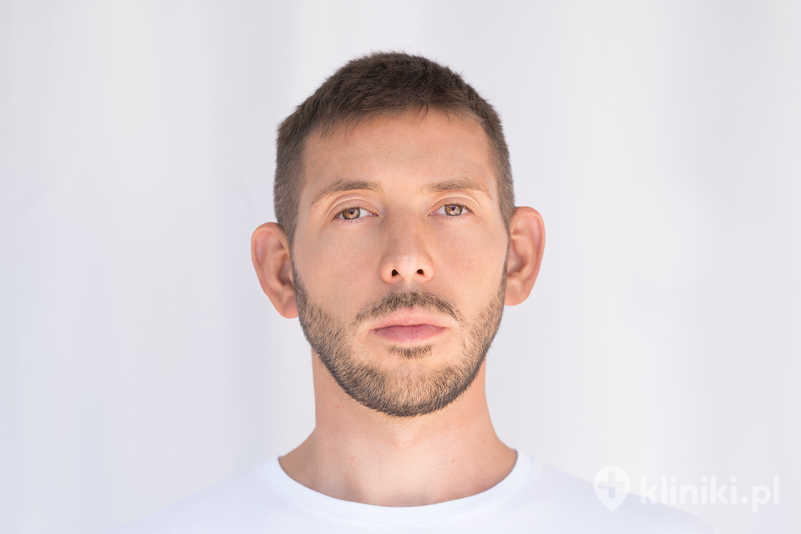 Korekcja uszu wykonywana jest u dzieci i dorosłych