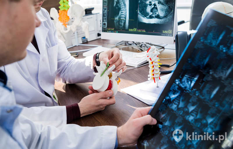 Mikrodiscektomia odciąża uciśnięty nerw