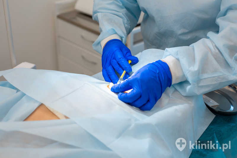 Blokada nadoponowa to metoda znieczulenia stosowana w chirurgii i położnictwie