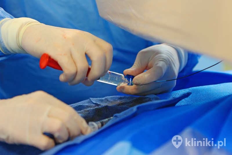Dyskoliza ozonowa polega na podaniu mieszaniny tlenu i ozonu bezpośrednio do zmienionego krążka międzykręgowego