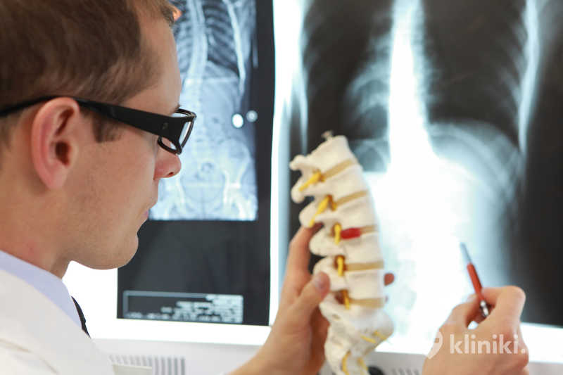 Laminektomia jest najczęściej wykonywana u pacjentów z stenozą kanału kręgowego