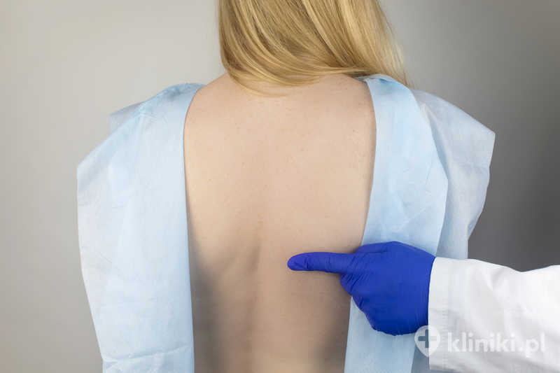 Stabilizacja otwarta kręgosłupa pozwala na odciążenie struktur nerwowych i poprawę stabilności mechanicznej