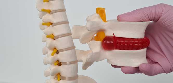 Stabilizacja Otwarta
