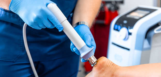 Fala uderzeniowa w leczeniu ostrogi piętowej