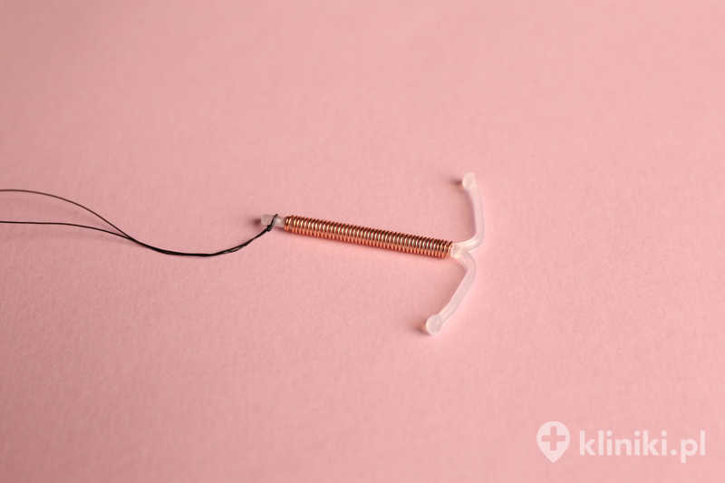Antykoncepcja kobiet obejmuje także metody mechaniczne, takie jak wkładki wewnątrzmaciczne